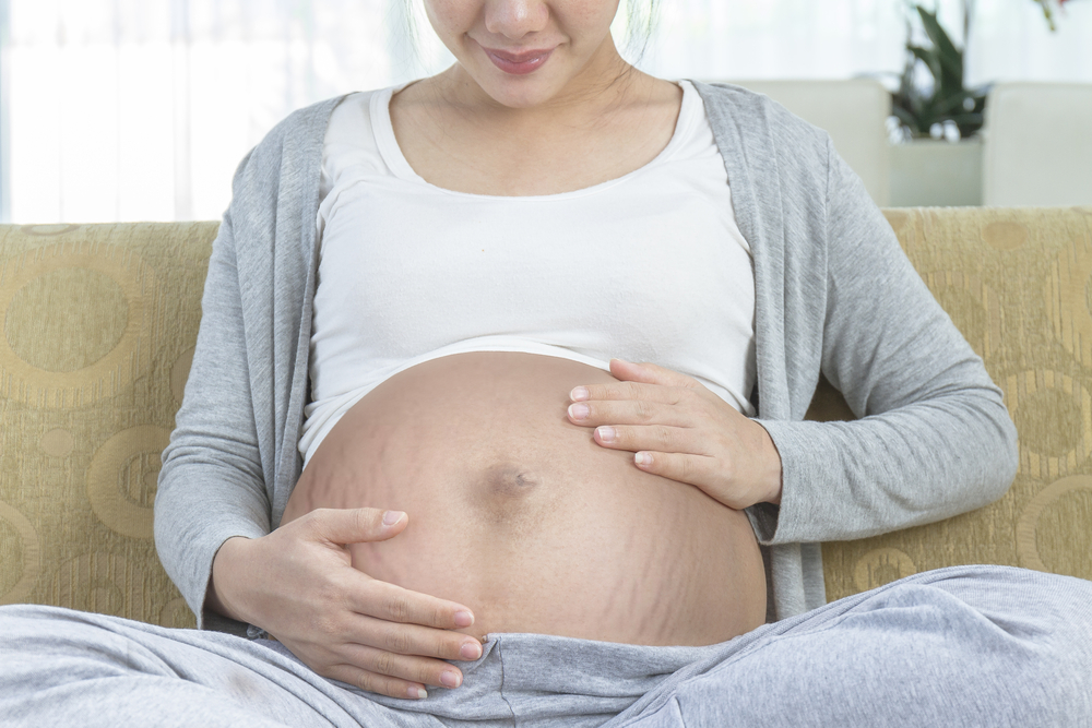 Stretch Marks. What Are The Causes And Remedies?